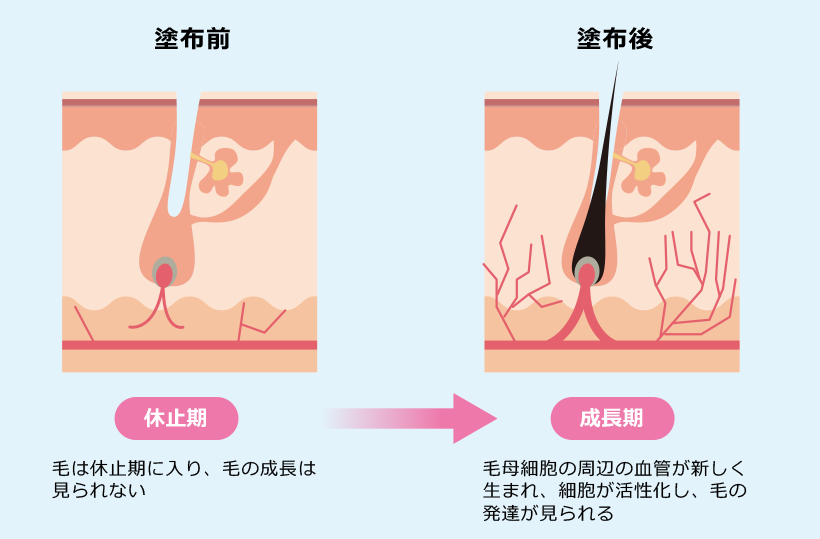 ミノキシジルの発毛メカニズム